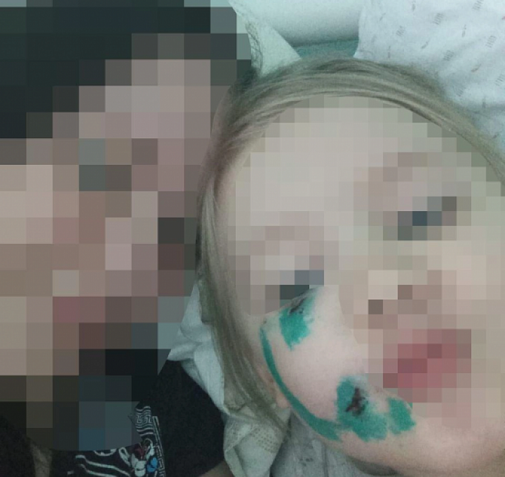 Мать покусанного собакой ребенка под Ростовом пожаловалась на травлю